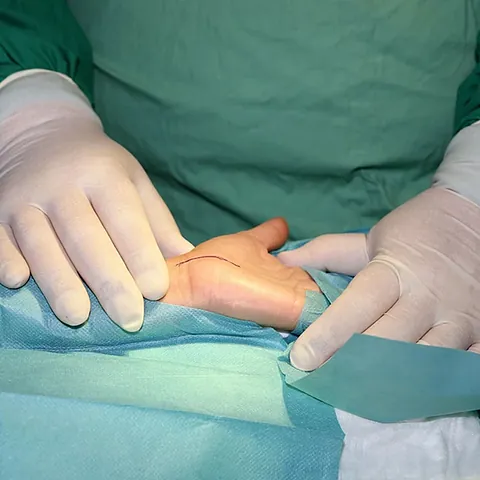 Periphere Nervenchirurgie in Graz