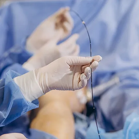 Gefäßchirurgie